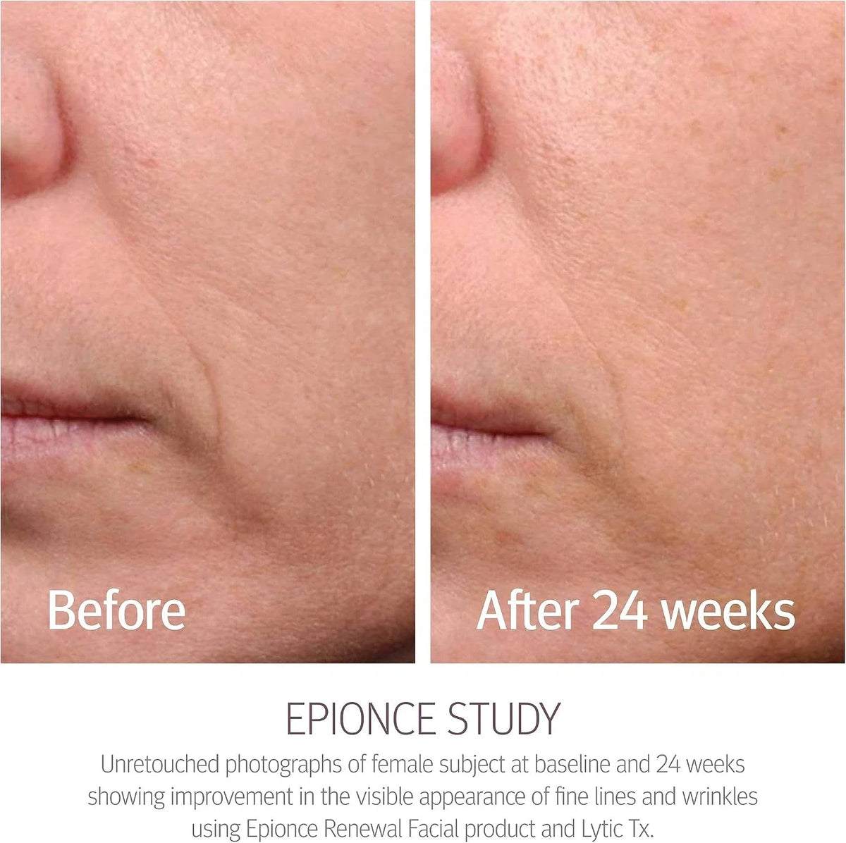 Epionce Renewal Facial Lotion 50ml