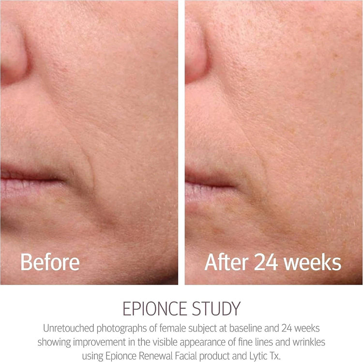 Epionce Renewal Facial Lotion 50ml